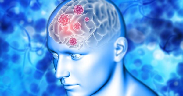 Fazy rehabilitacji neurologicznej po udarze mózgu