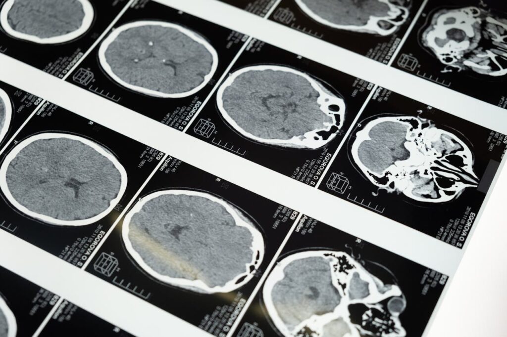 diagnoza i leczenie chorób przysadki mózgowej
